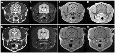 Case report: Recovery and sequential imaging of a patient with osmotic demyelination syndrome